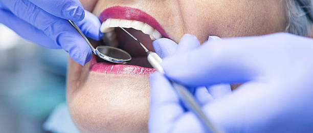 Best Emergency Root Canal Treatment in Baileyton, AL